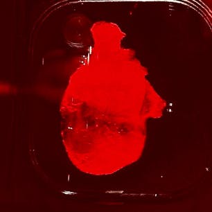 大阪関西万博
パソナ館
1枚目はiPS心臓、ドクドクと動いています。2枚目はiPS心筋シートです。